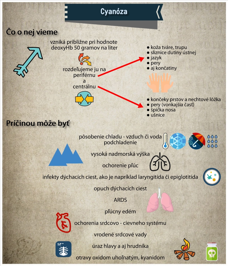 Čo by sme mali vedieť o cyanóze Infografika uvádza súhrnné informácie k cyanóze