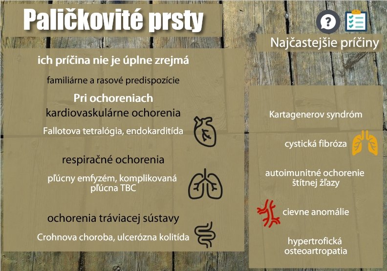 Súhrn najčastejších príčin Najčastejšie príčiny paličkovitých prstov zhrnuté v infografike