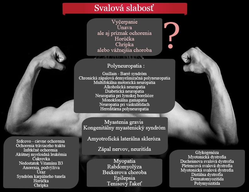 Súhrn príčin svalovej slabosti Infografika uvádza príčiny svalovej slabosti