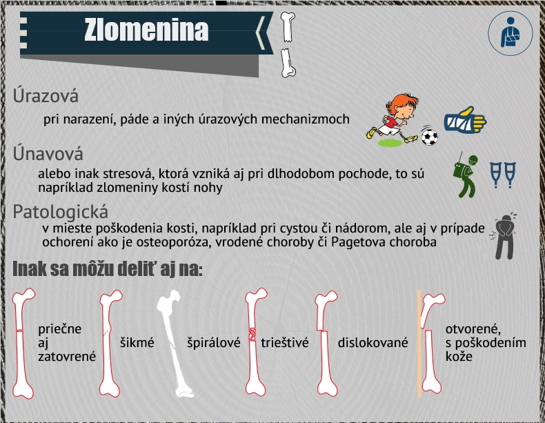 Zlomeniny sa delia na viac druhov Infografika znázorňuje niektoré druhy zlomenín