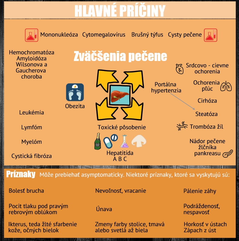 Súhrn najčastejších príčin a hlavné príznaky, ktoré sa môžu vyskytnúť pri hepatomegálii Infografika uvádza najčastejšie príčiny zväčšenia pečene a príznaky, ktoré sa môžu vyskytnúť