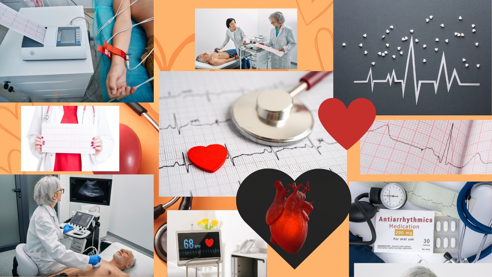 Koláž obrázkov, ktoré znázorňujú lekára, EKG, pacienta, srdce, srdcovú činnosť, vyšetrenie