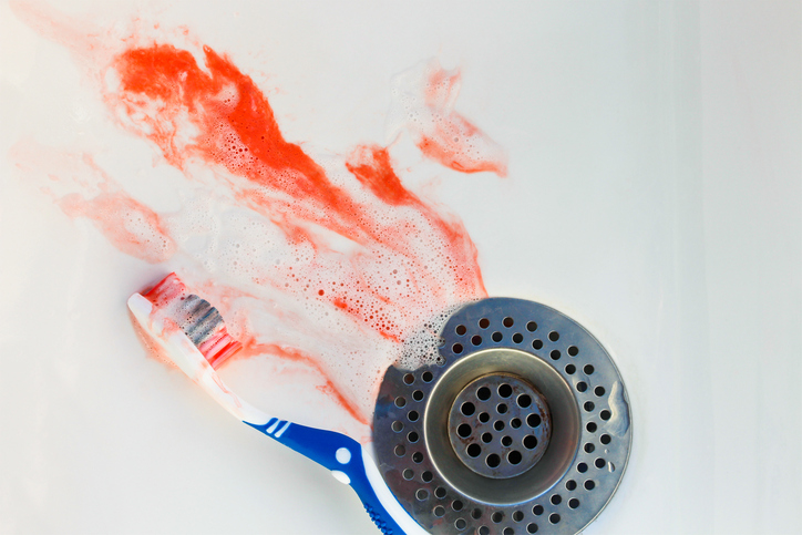 Krvácanie z ďasien, umývadlo, krv, zubná pasta, zubná kefka, nsprávna ústna hygiena, nevhodné umývanie zubov