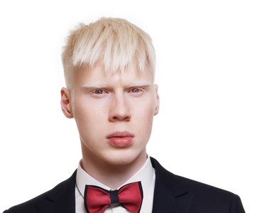 mladý muž albín, biele vlasy, v saku