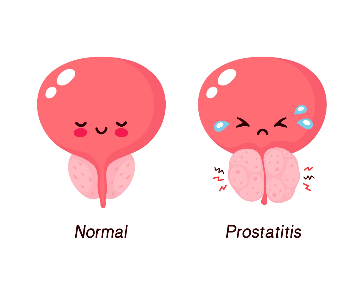 Normálne močenie a prostata rozdiel