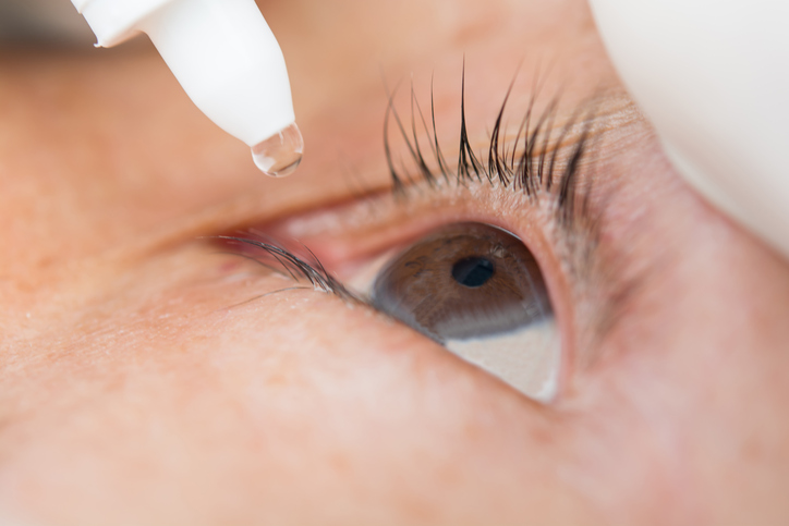 aplikácie očných kvapiek do oka, ako napríkald pri syndróme suchého oka alebo pri zápale