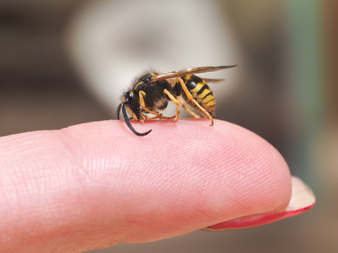 Osa sedí na prste, ako znak alergie na uštipnutie hmyzom