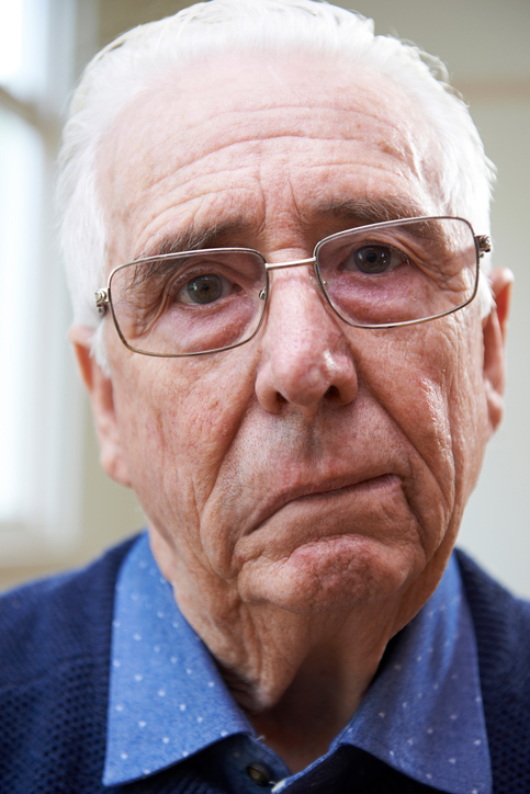 Starší muž má parézu nervu facialis, teda tvárového nervu, pri periférnej príčine aj pri cievnej mozgovej príhode