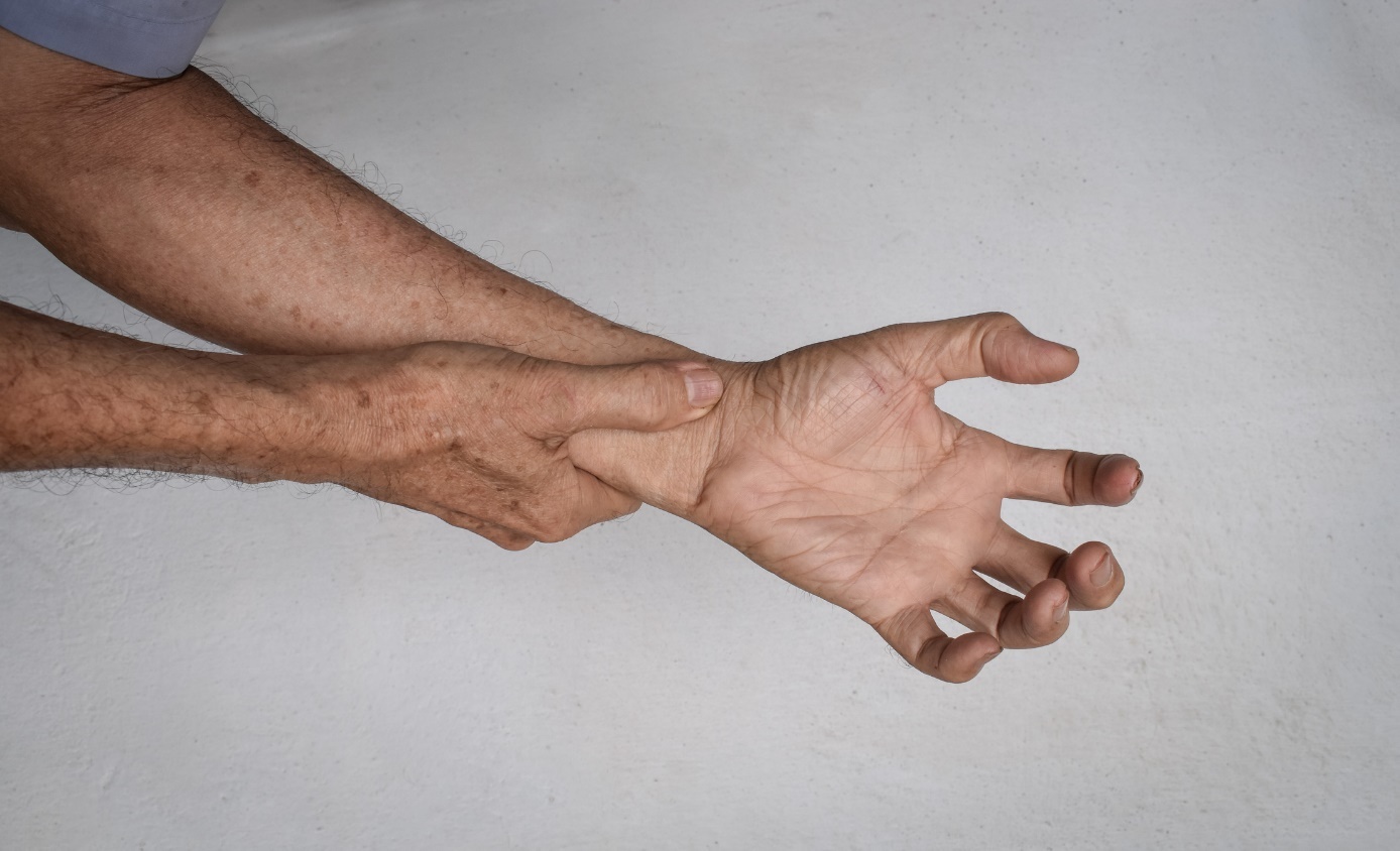 Staršia osoba si drží rukou zápästie. Syndróm karpálneho tunela ako možná príčina úbytku svalstva