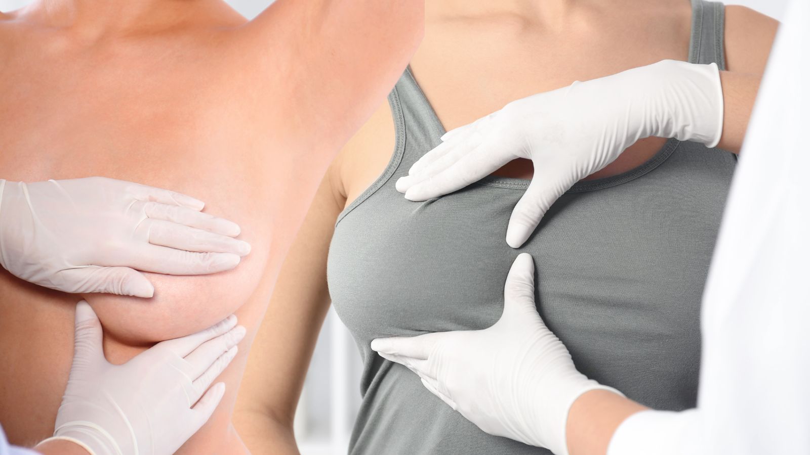 Vyšetrenie prsníkov u lekára - koláž dvoch obrázkov pri vyšetrení druhou osobou