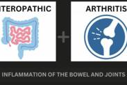 Enteropatická artritída