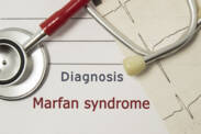 Marfanov syndróm