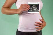 16. týždeň tehotenstva TT: Čo ukáže ultrazvuk? Ako sa budúca mamička má?