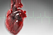 Aký je život po srdcovom infarkte? Má obmedzenia, spôsobí práceneschopnosť?