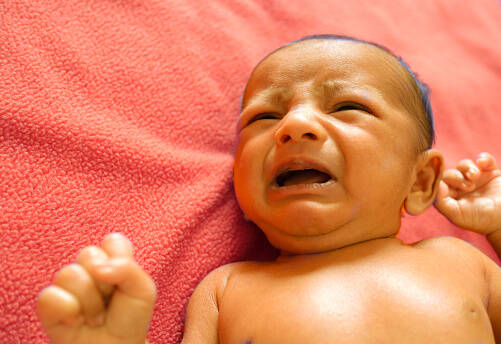 Kedy je novorodenecká žltačka nebezpečná? Čo je a prečo vzniká ikterus u novorodencov?