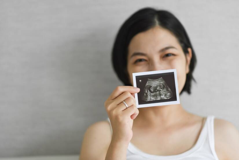 12. TT týždeň tehotenstva: Má plod skutočnú podobu dieťatka?