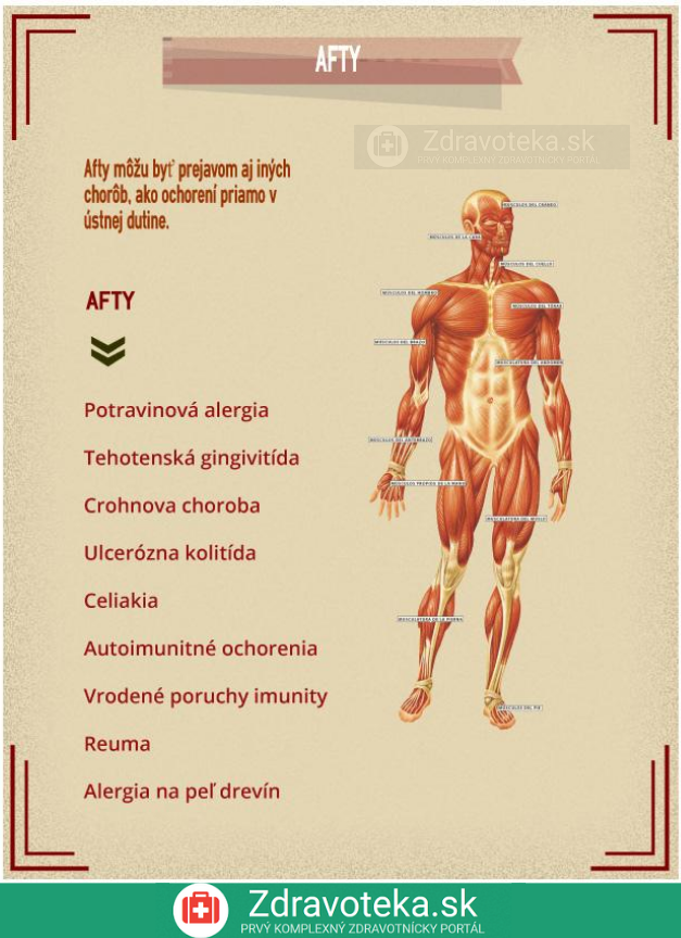 Infografika: Afty - najčastejšie ochorenia spájané s aftami