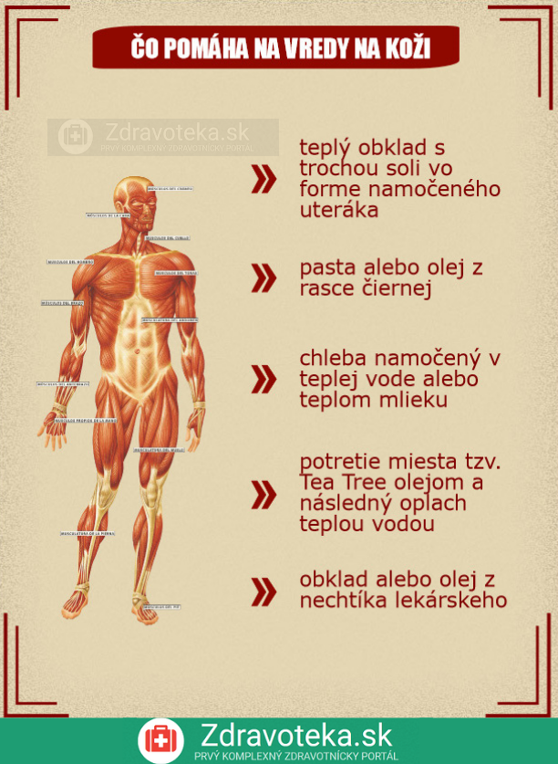 Infografika: Čo pomáha na vredy na koži?