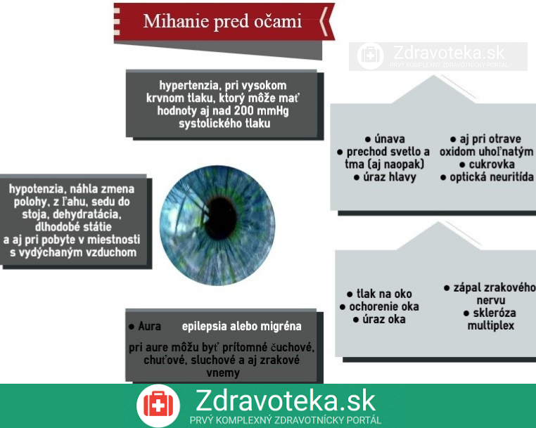 Infografika: Najčastejšie príčiny mihania pred očami
