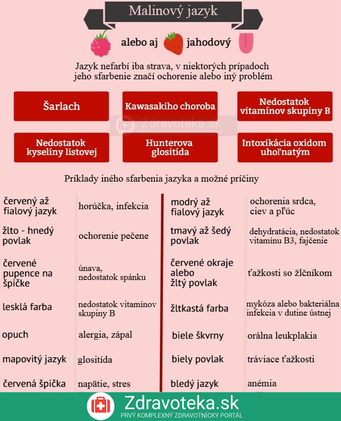 Infografika: Príčiny malinového jazyka. Iné možné farby a ich príčiny