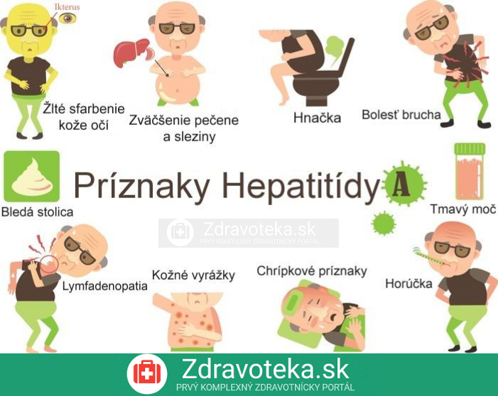 Infografika: Príznaky hepatitídy typu A