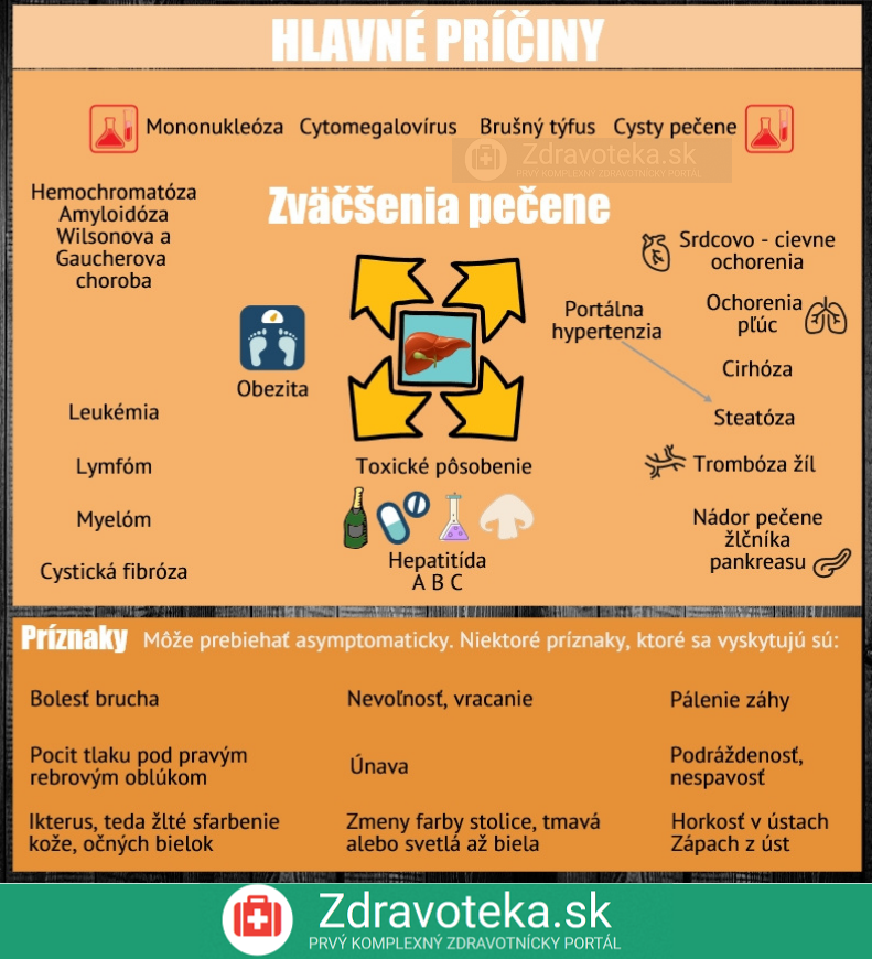 Infografika: Zväčšenie pečene - príčiny a príznaky