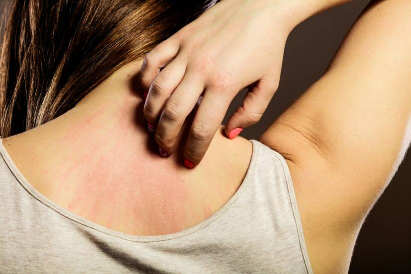 Z čoho vzniká a aké má príčiny začervenaná koža a jej svrbenie?