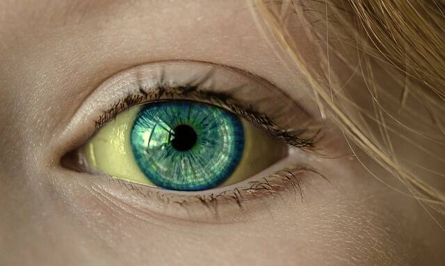 Z čoho môžu byť žlté bielka očí?