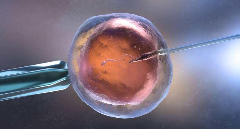 In vitro fertilizácia IVF . Zdroj foto: Getty Images