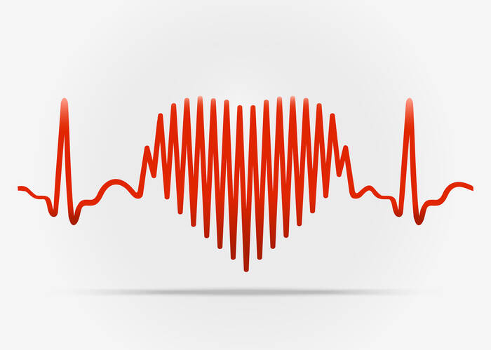 Arytmia: Čo je to srdcová arytmia a ako sa prejavuje?