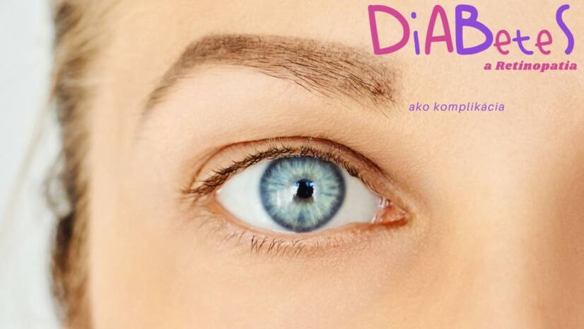 Diabetická retinopatia: Čo je to, prečo vzniká a aké má príznaky?