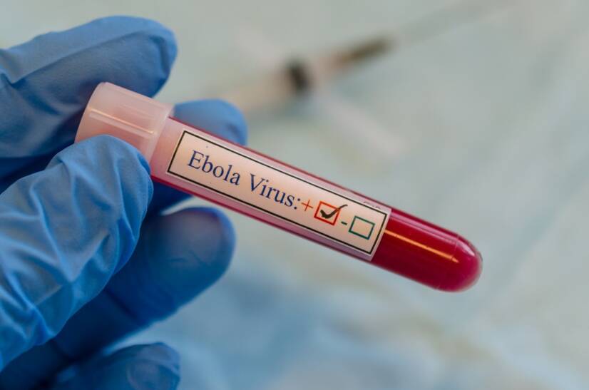 Ebola: Prenos, čo spôsobuje - aké príznaky? Situácia na Slovensku