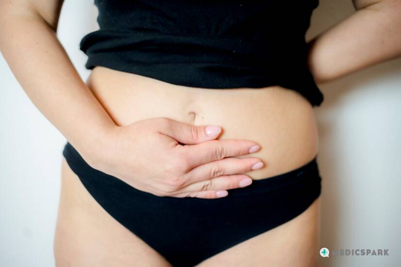 Endometrióza: čo to je? Príčiny, príznaky a liečba. + Vplyv na plodnosť ženy