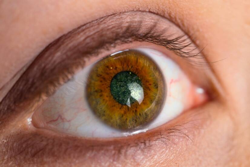 Glaukóm či zelený zákal: Aké má príčiny, príznaky a diagnostiku?