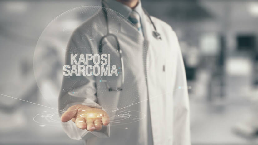 Kaposiho sarkóm a hľadanie odpovedí: Aké má príčiny a príznaky?
