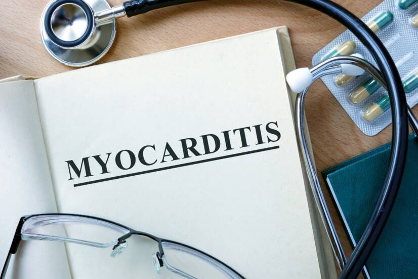 Myokarditída: Zápal srdcového svalu. Príčiny a príznaky