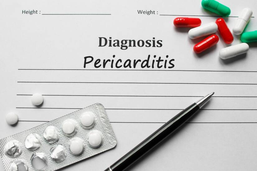Perikarditída: Zápal srdcového obalu. Aké má príčiny a príznaky?