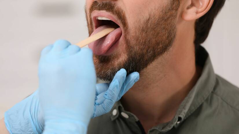 Rakovina ústnej dutiny (pier a jazyka): Aké má príčiny a prejavy? Myslite na dôležitosť prevencie