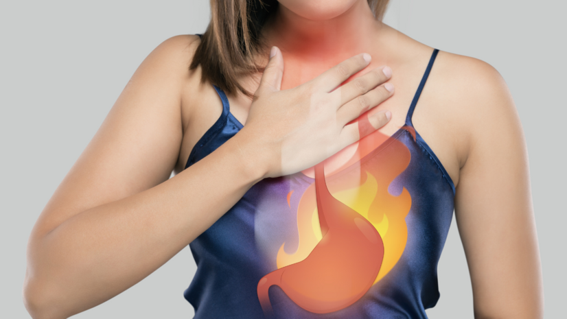 Gastroezofágová refluxová choroba: pálenie záhy a ochorenie pažeráka
