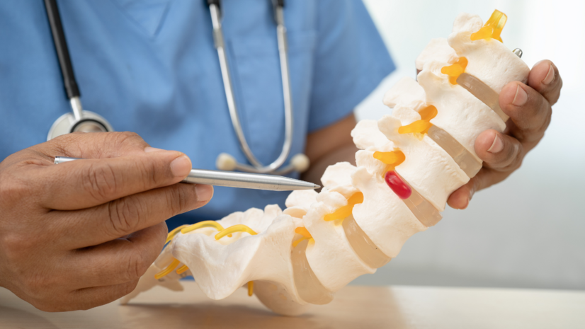 Spondylartróza: čo to je? Príznaky, príčiny a liečba artrózy medzistavcových kĺbov