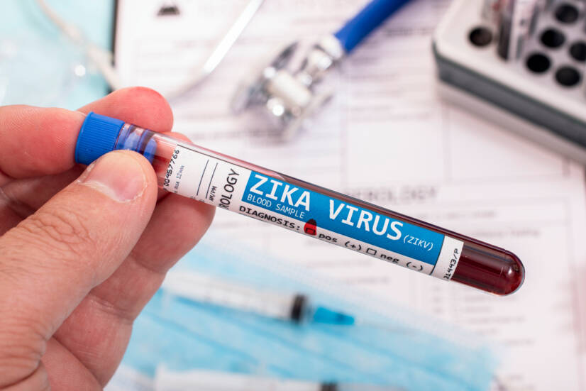 Vírus Zika: Čo je, ako sa prenáša, aké má príznaky? V tehotenstve rizikom