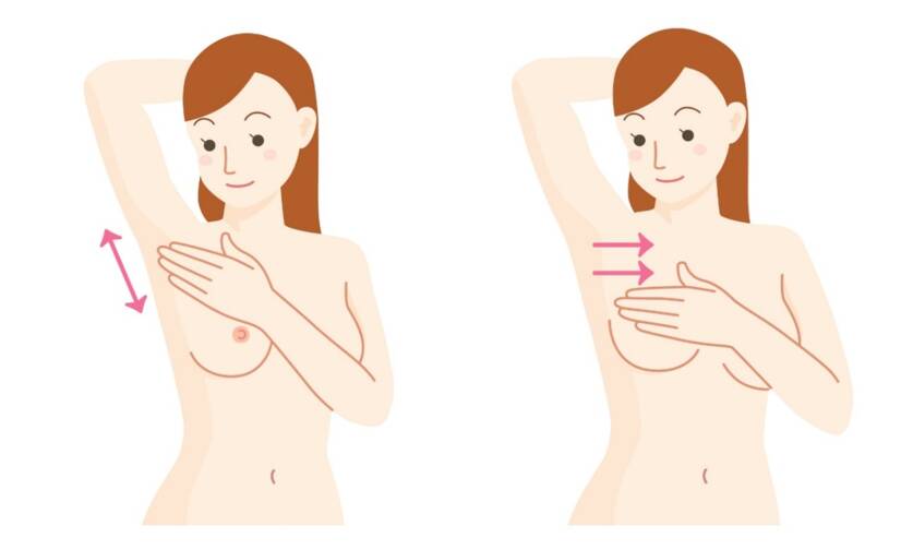 Samovyšetrenie prsníkov: Ako krok za krokom k prevencii a zdraviu pŕs?