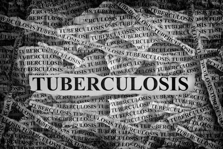 Tuberkulóza nepatrí minulosti, ročne zabíja milióny ľudí. Poznáte fakty a mýty?