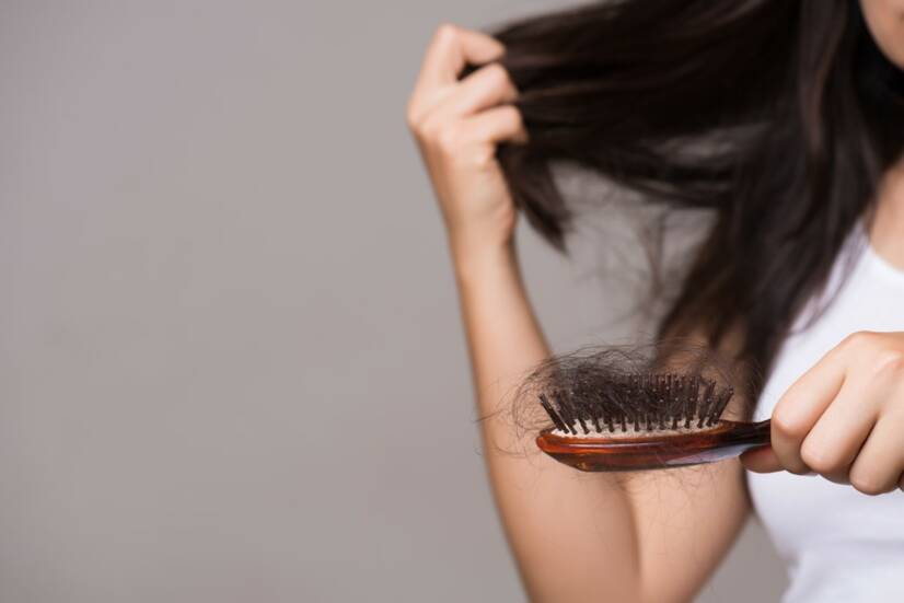 Nadmerné vypadávanie vlasov a jeho príčiny: Čo pomôže a ako sa lieči?