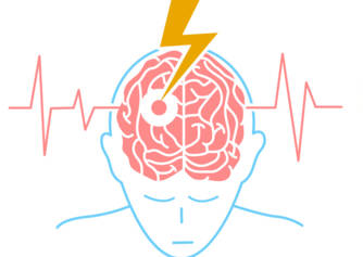 Čo je to cievna mozgová príhoda? Poznáte príznaky, riziká či diagnostiku?