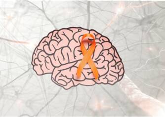 Čo sú to neurofilamenty a prečo sa vyšetrujú? Moderný nástroj v monitoringu sklerózy multiplex