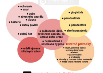 Infografika: Aké sú hlavné príčiny kývania zubov?