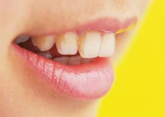Kývanie zubov: Aké sú príčiny (v dospelosti i u detí)?
