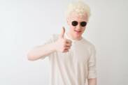 Albinizmus ako genetická porucha s dopadom na pokožku i oči