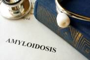 Amyloidóza: Čo je a prečo vzniká, aké má príznaky?